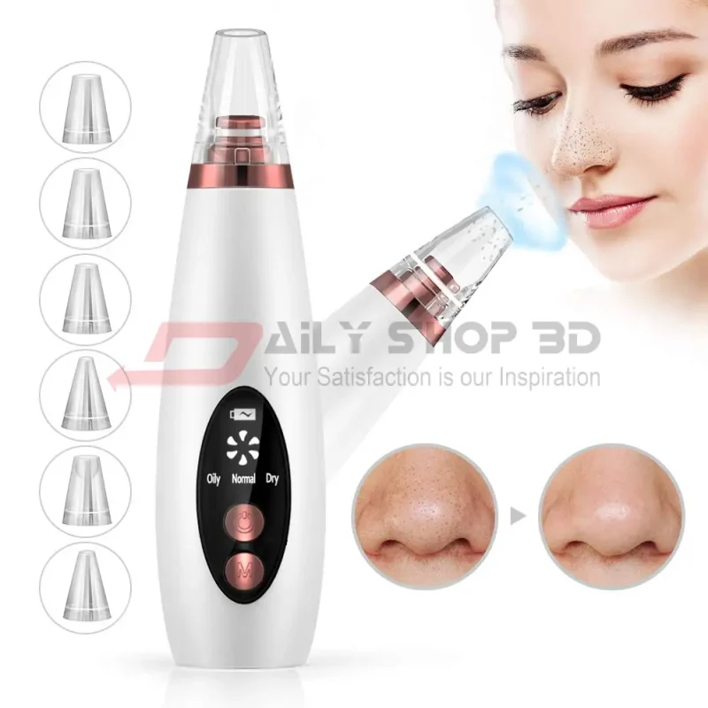 Electric Blackhead Remover - Image 2