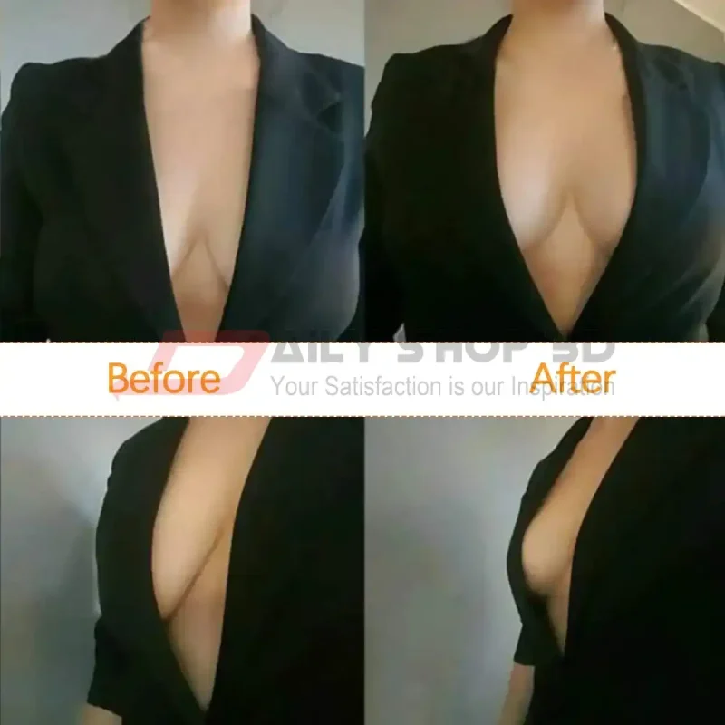 Rabbit Ear Silicone Bra - Image 5