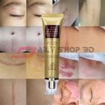 Lanbena TCM  Scar Removal Cream -30ml
